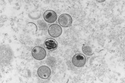 世衛(wèi)組織：全球超過18000例猴痘病例大部分在歐洲