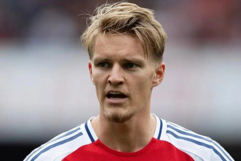 阿爾特塔：厄德高腳踝受傷“相當(dāng)嚴(yán)重”