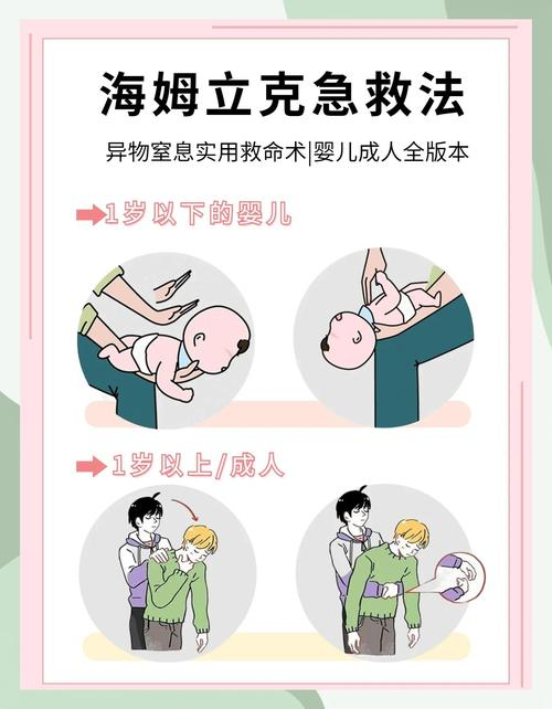 海姆立克急救法